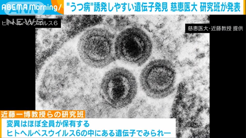 うつ病　誘発しやすい遺伝子発見　遺伝子との関係も