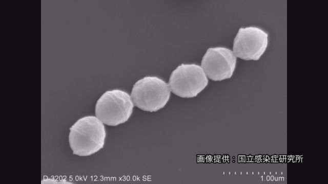 【感染症】致死率3割～7割「劇症型溶連菌」過去最多の去年上回るペースで増加 約2か月で378人 去年の4割超